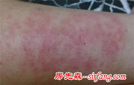 家里摆这些花，身体会出问题！这8种花别在室内养